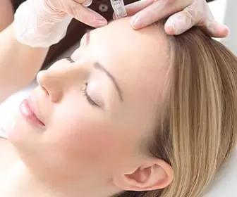 Microneedling Facial treatment