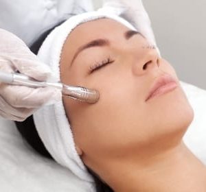 microdermabrasion treatment model