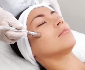 microdermabrasion treatment model