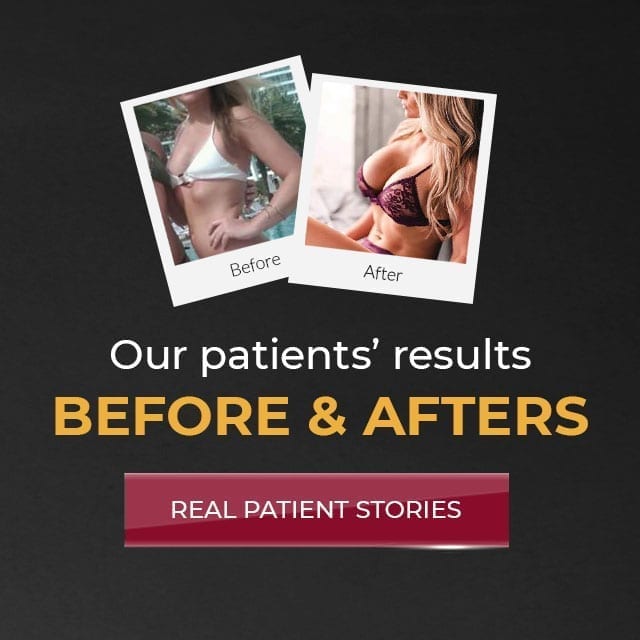 Our patients' results: before and afters real paitent stories