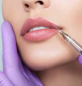 cherry hill lip filler