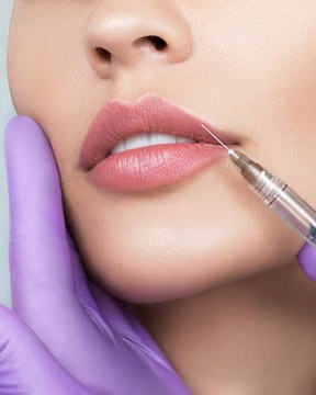 cherry hill lip filler