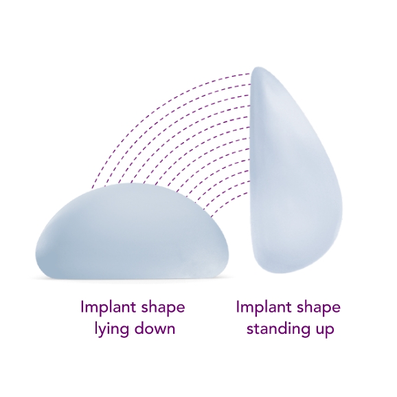 motiva breast implant ergonomix