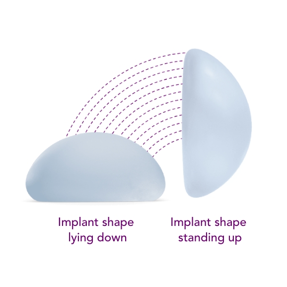 motiva breast implant round